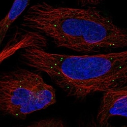 PHOSPHO2 Antibody, Novus Biologicals 25 &mu;L; Unlabeled:Antibodies, Polyclonal